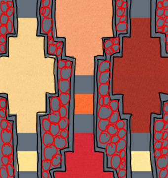 Lanterns Quilt Path step 3